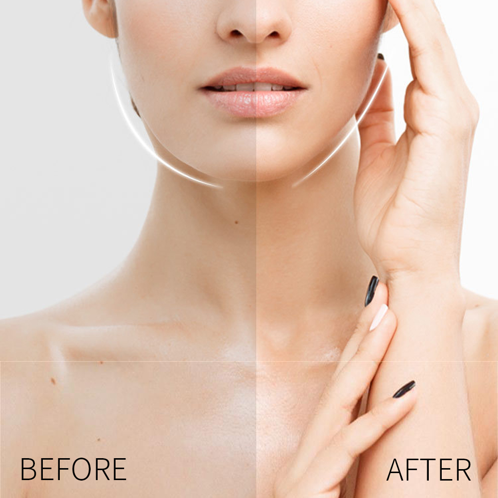Nastri per il lifting del viso - Beauty Makeup Face recensione e prezzo